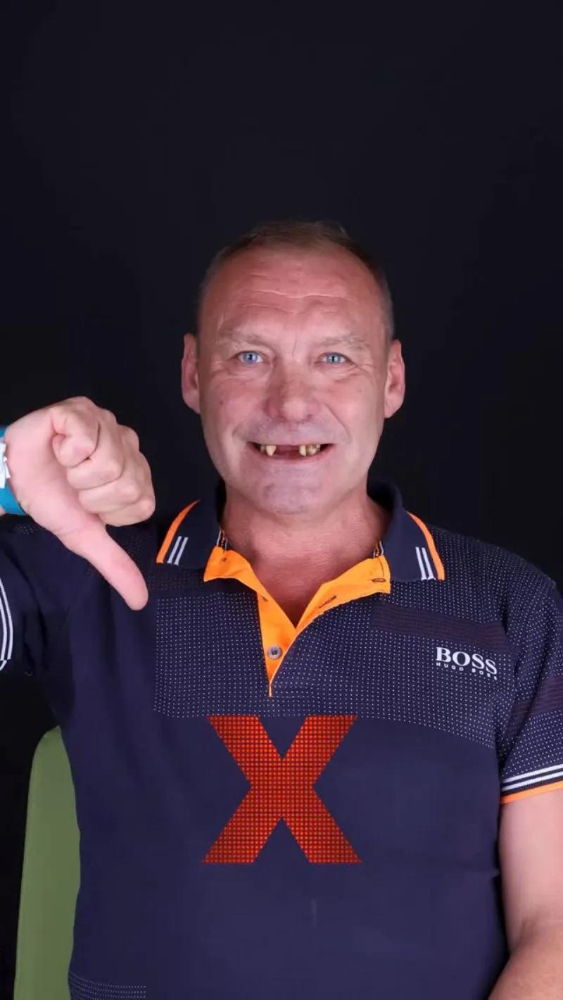 Zirkonyum Kron öncesi