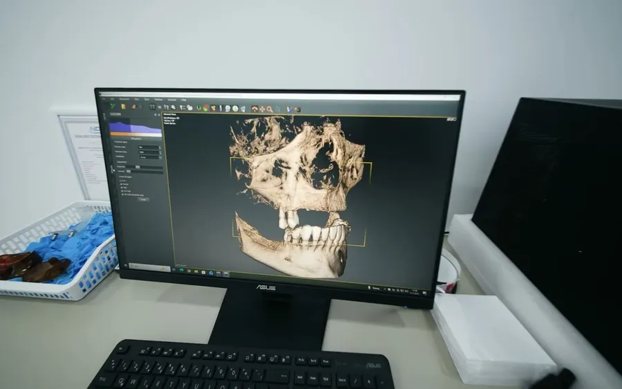 Dijital gülüş tasarımı — Sirius Dental Clinic