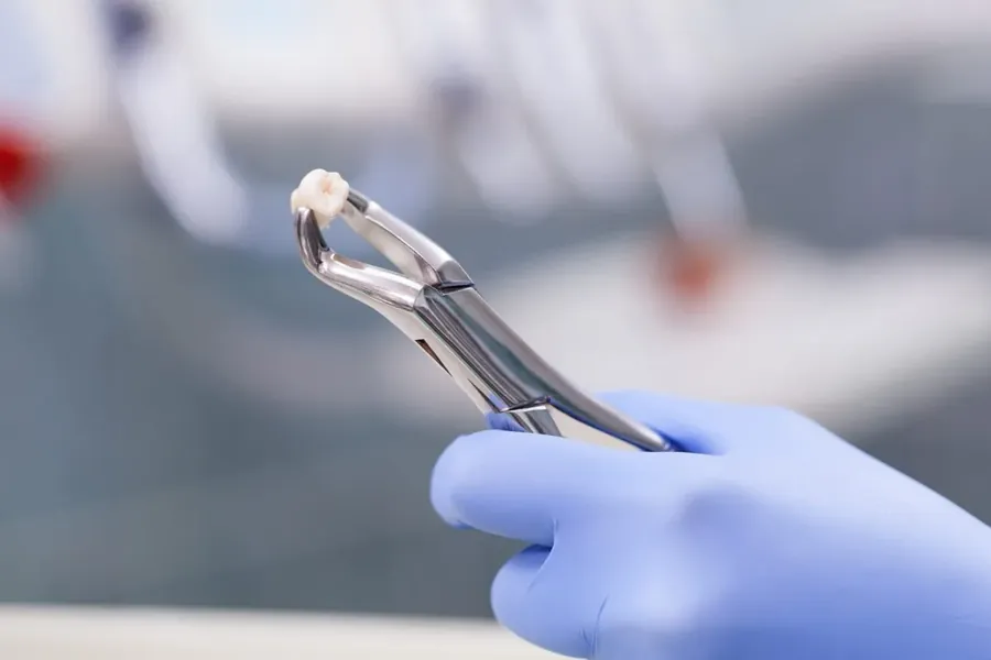 All-on-4 implant treatment — fixed teeth in a single day