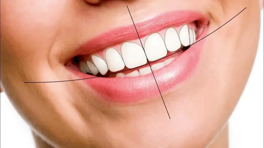 What Is Smile Design and Who Is It For?