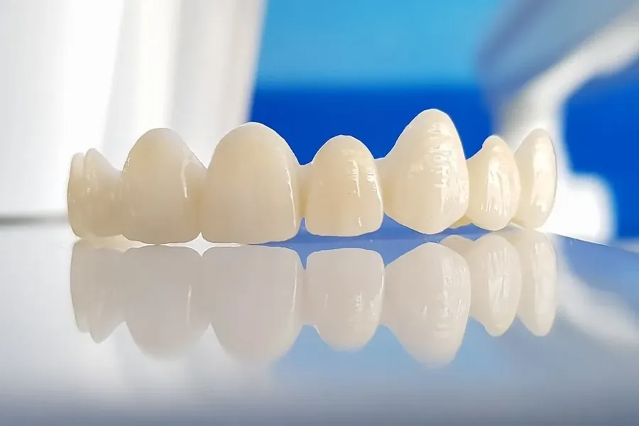 Vergleich von Zirkonkrone und Keramik-Veneer